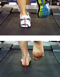 Laufbandanalyse der Junioren